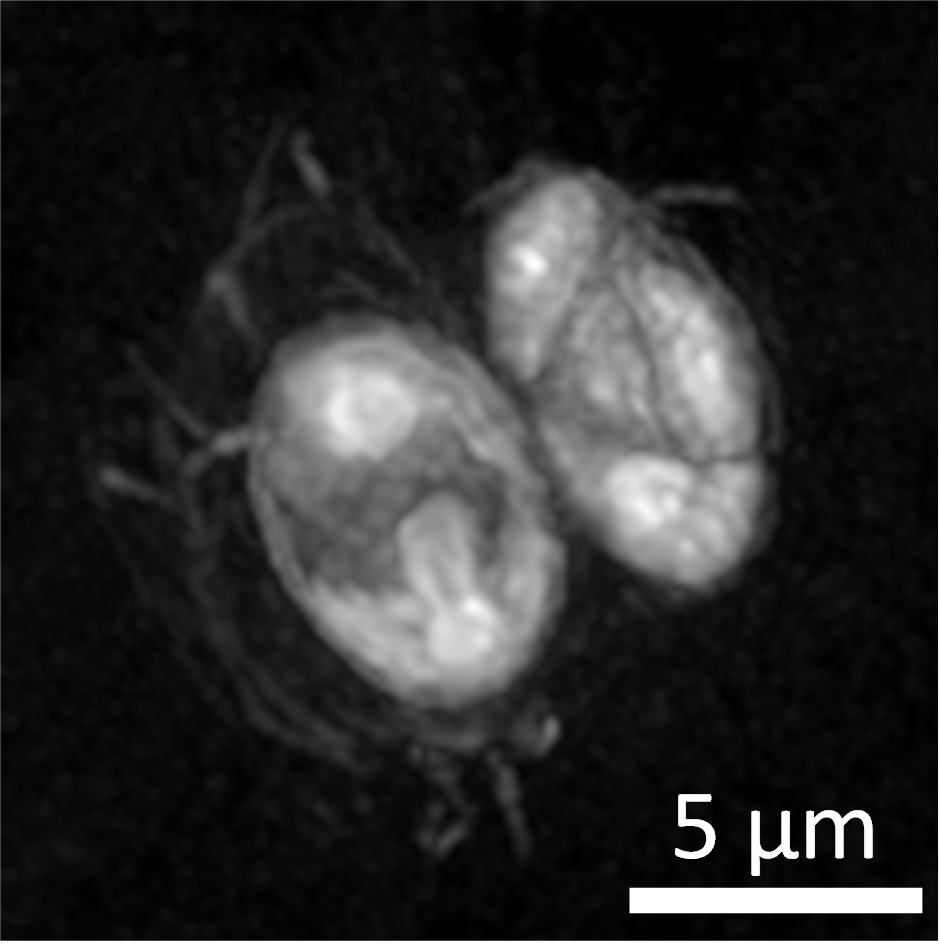 Holotomographie